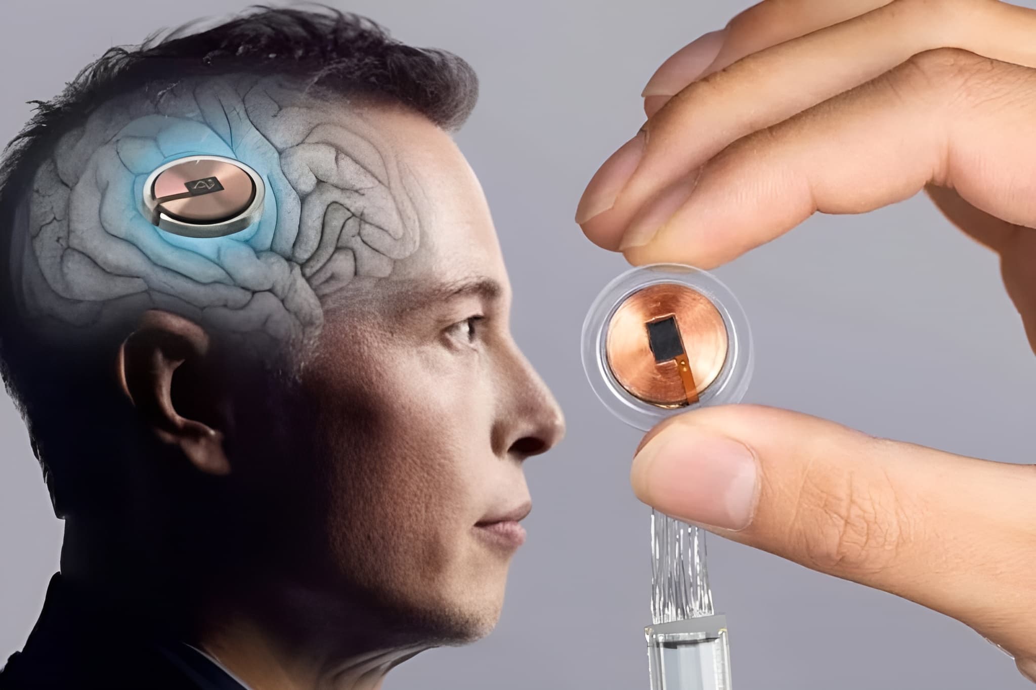 Neuralink mění životy